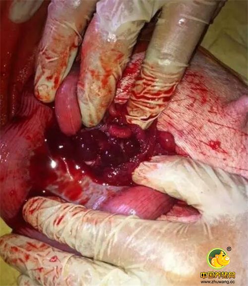 图为手术人员右手捏住子宫，左手翻转卵巢，看排卵情况及排卵个数。