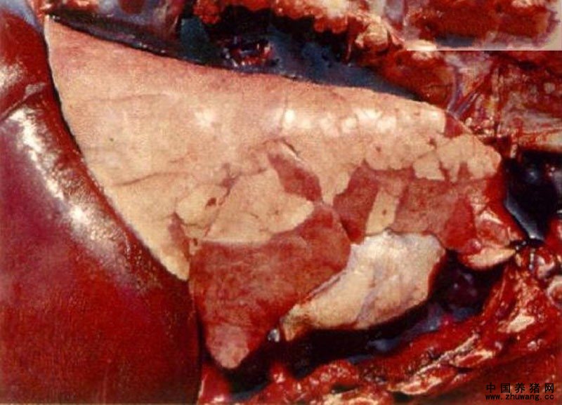 肺心叶、尖叶和横膈膜叶的前端有“鱼肉样”的肺炎